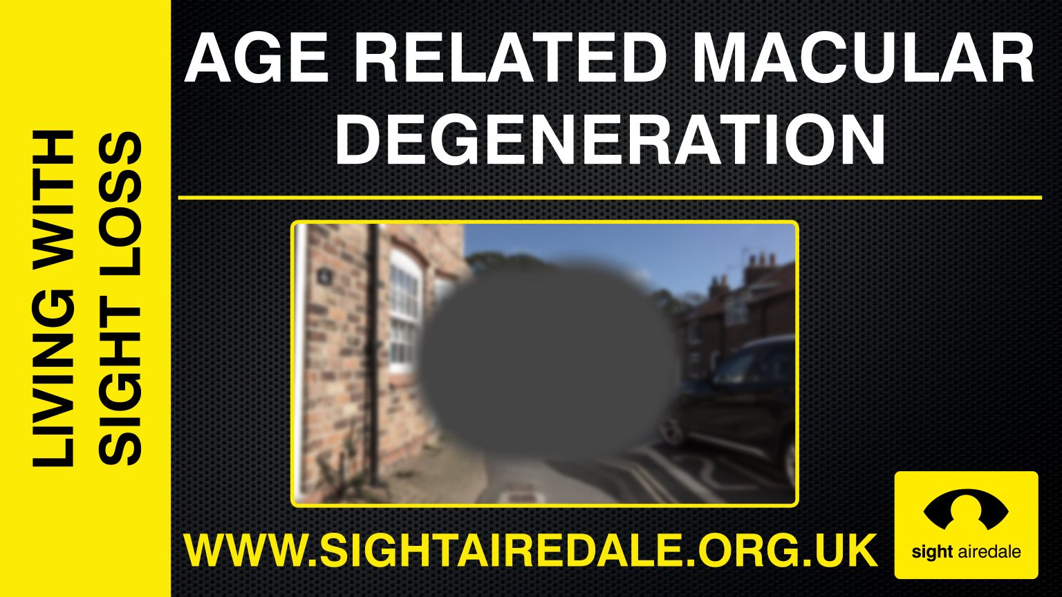What do Blind People See? Macular Degeneration